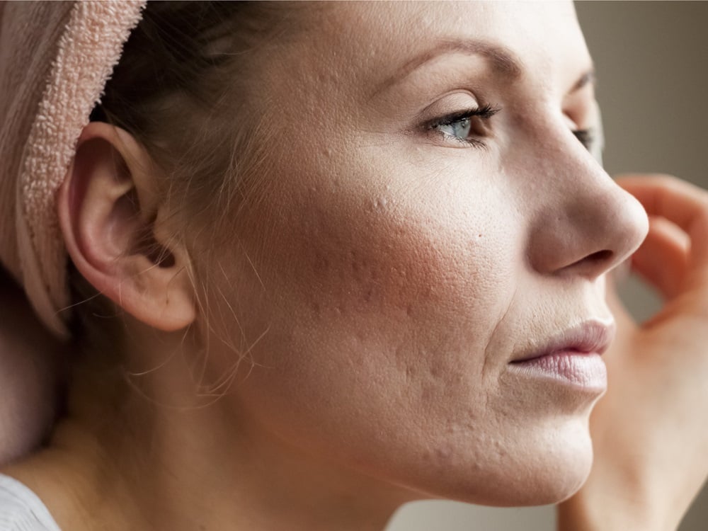 نشانه بیماری