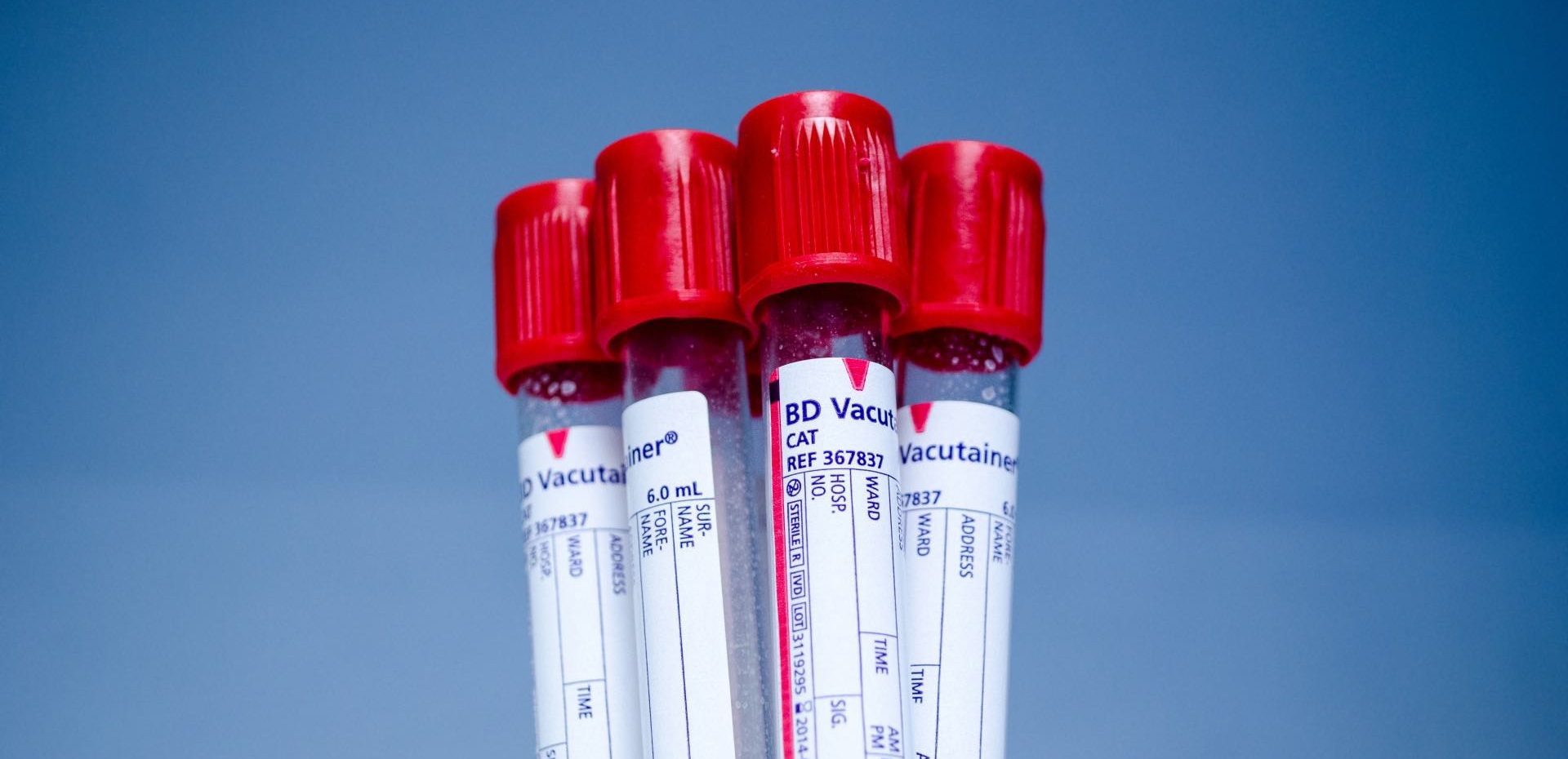 آزمایش های هورمونی