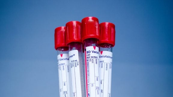 آزمایش های هورمونی