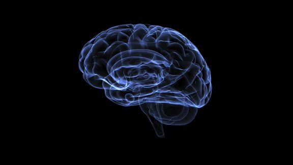 آسیب‌های مغزی