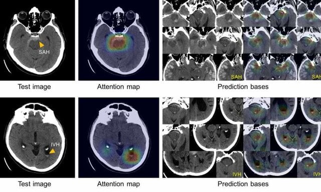 پیشرفت هوش مصنوعی