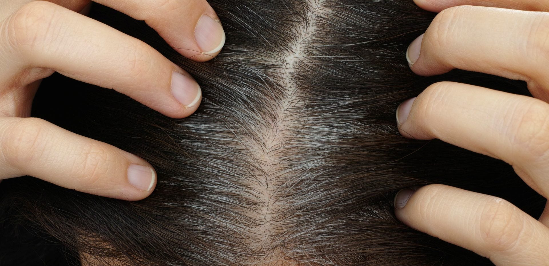 هشت ماده غذایی برای جلوگیری از ریزش مو