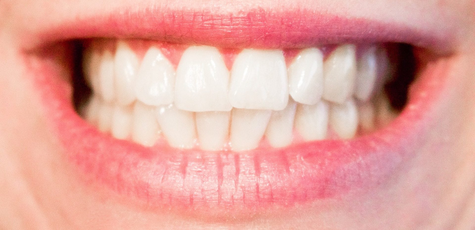 عوامل خرابی دندان‌ها