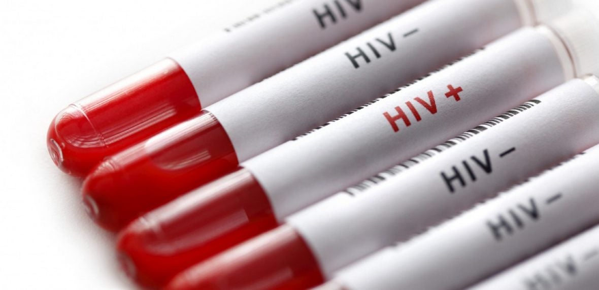 ویروس HIV از طریق سرنگ آلوده