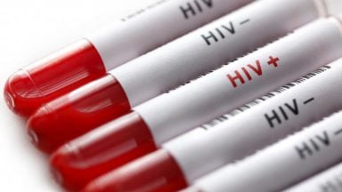 ویروس HIV از طریق سرنگ آلوده