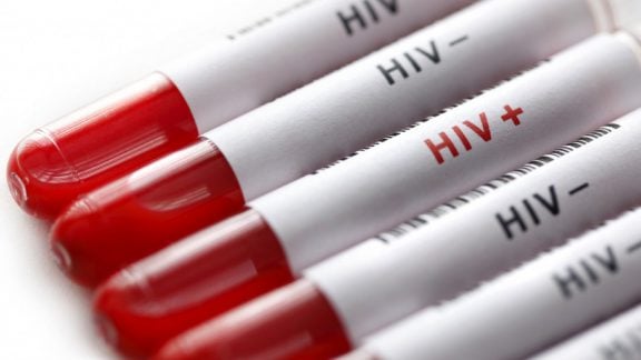 ویروس HIV از طریق سرنگ آلوده