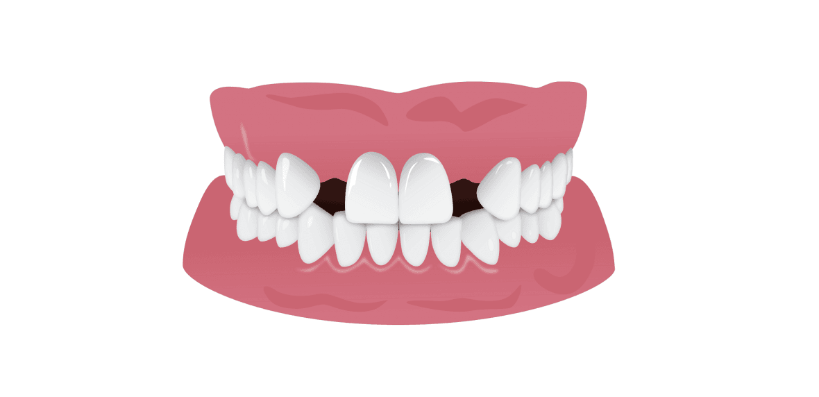 موارد مضر برای دندان