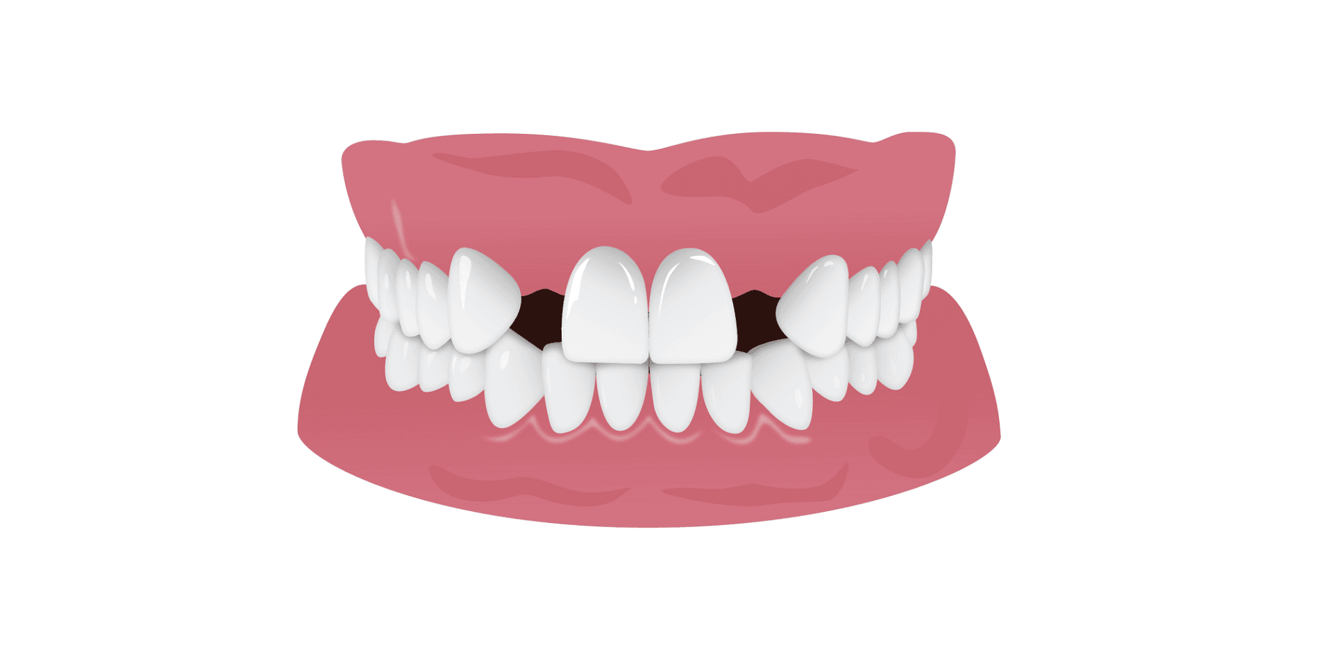 موارد مضر برای دندان