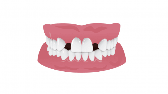 موارد مضر برای دندان