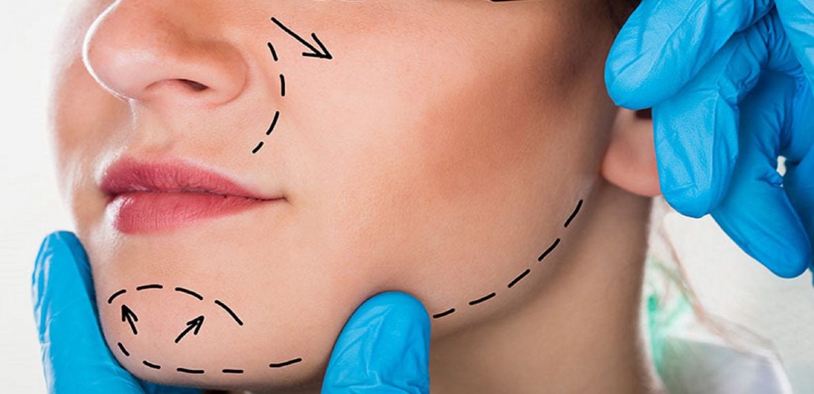 فیلترهای جراحی پلاستیک اینستاگرام