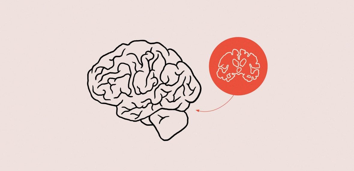 ارتباط کوچک شدن مغز و تنهایی