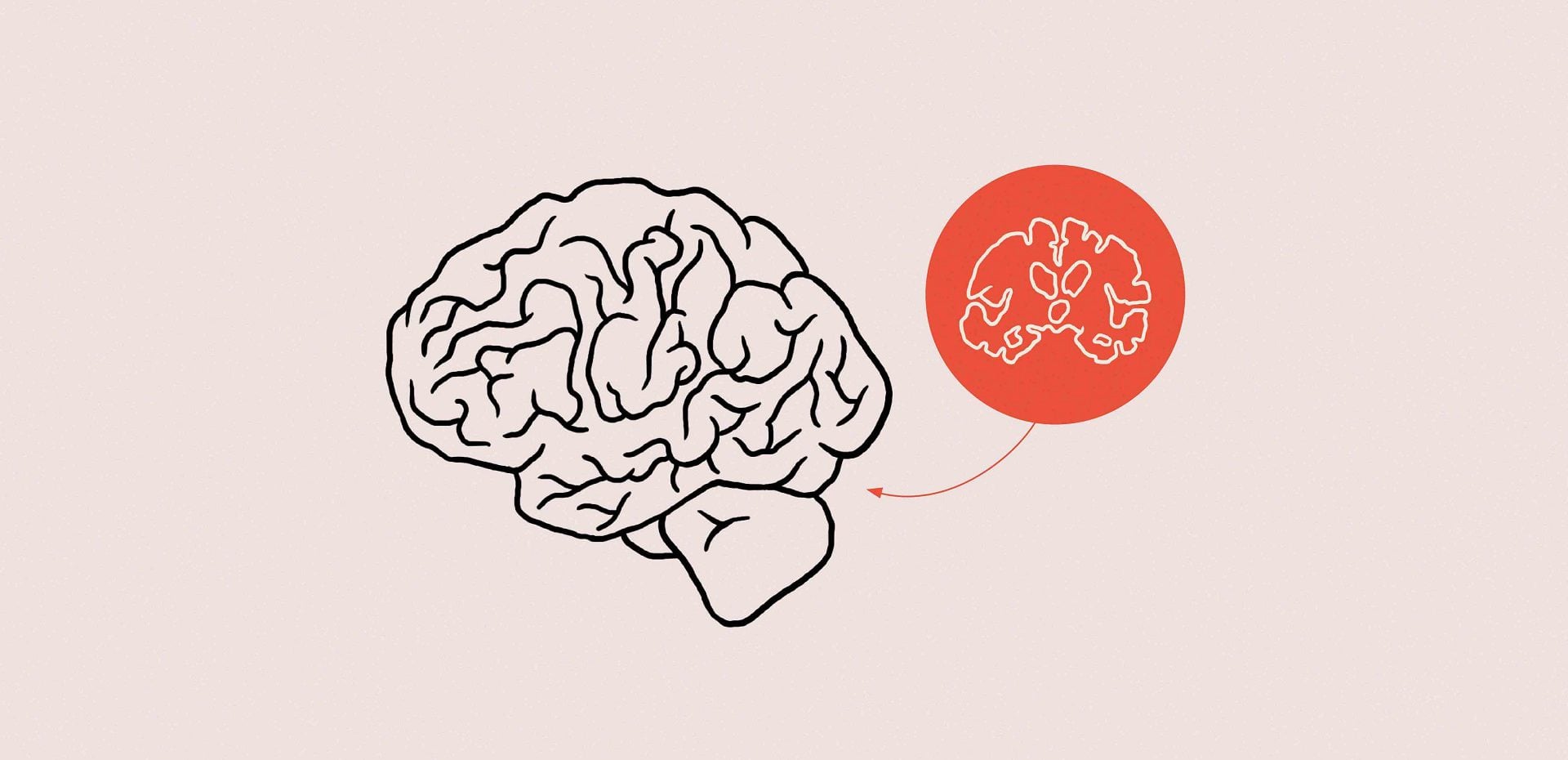 ارتباط کوچک شدن مغز و تنهایی