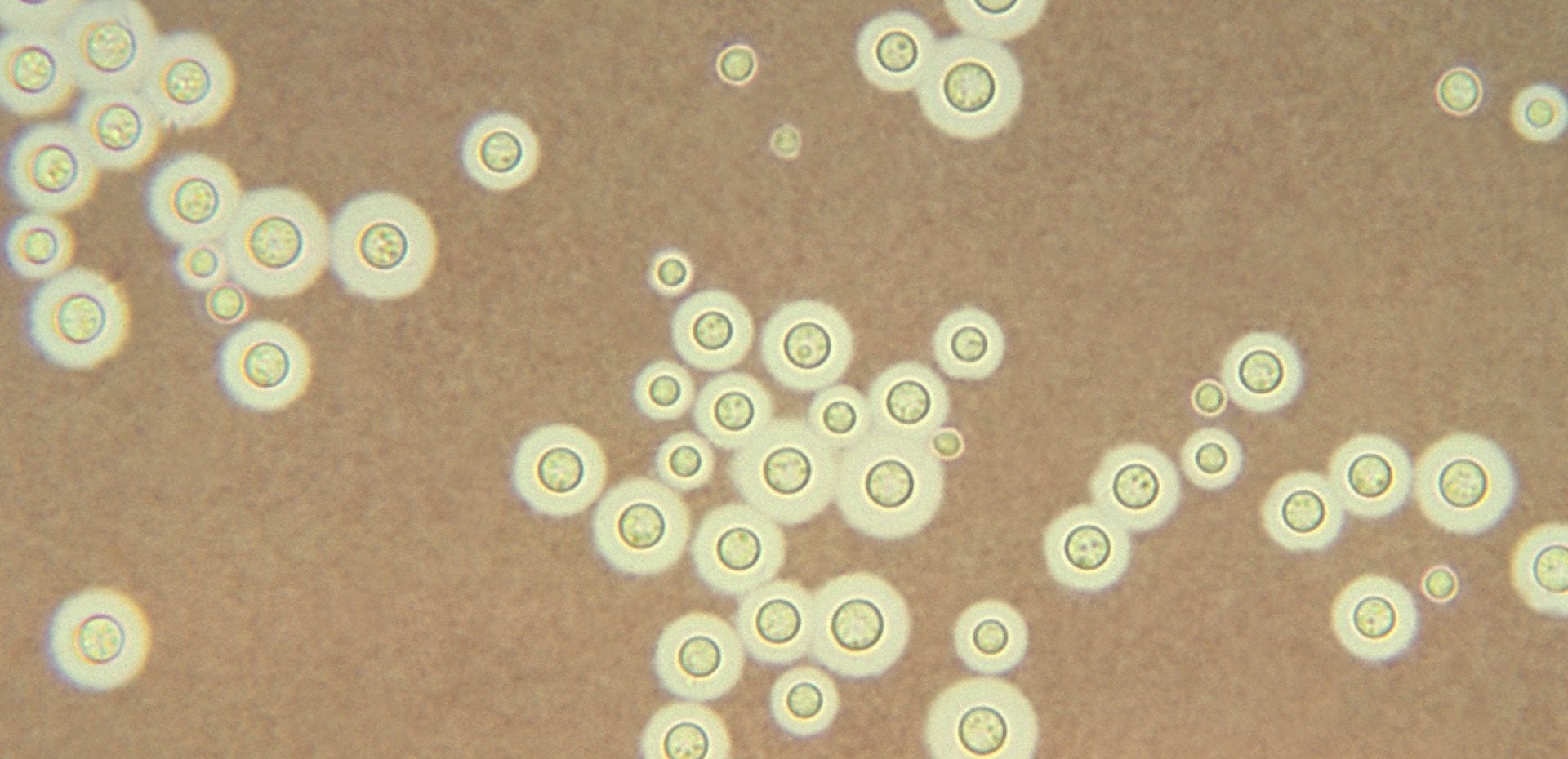 قارچ‌های منطقه چرنوبیل