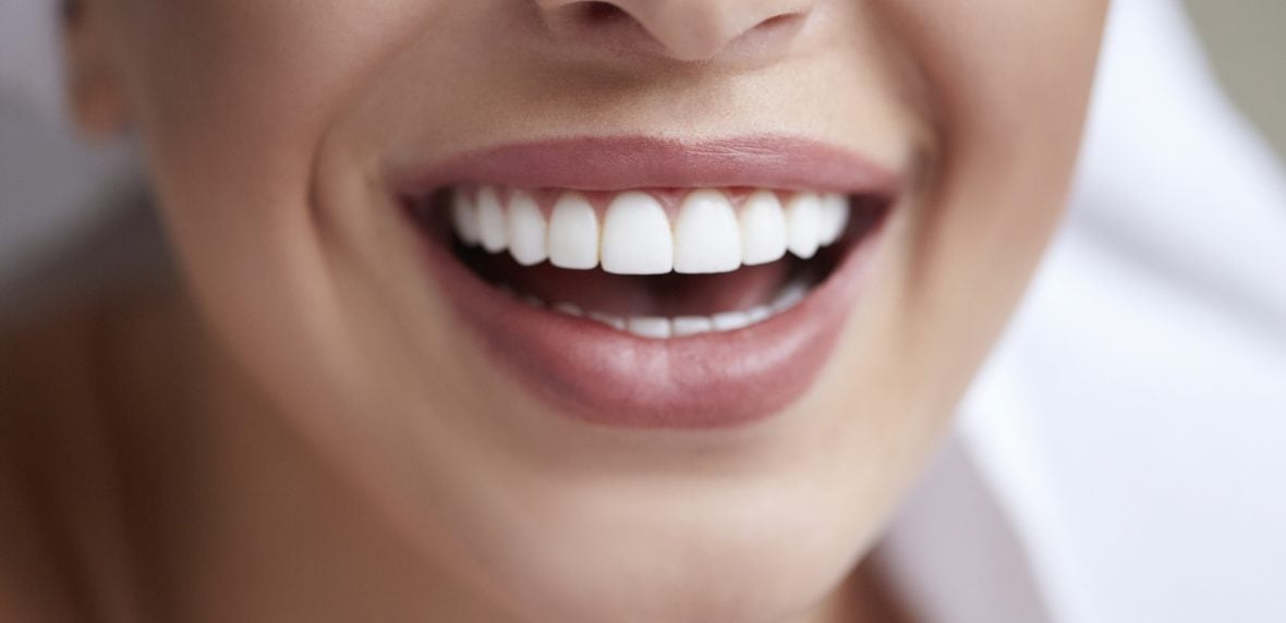 سفید کردن دندان