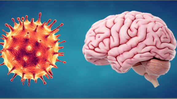 سلول های مغز