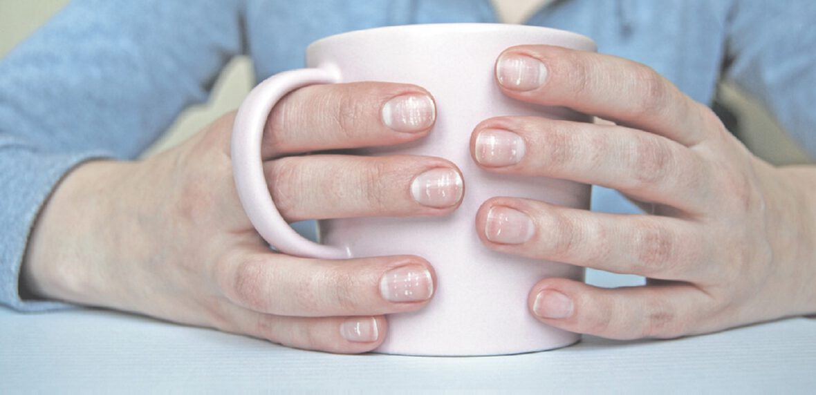 لکه های سفید ناخن