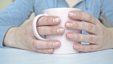 لکه های سفید ناخن