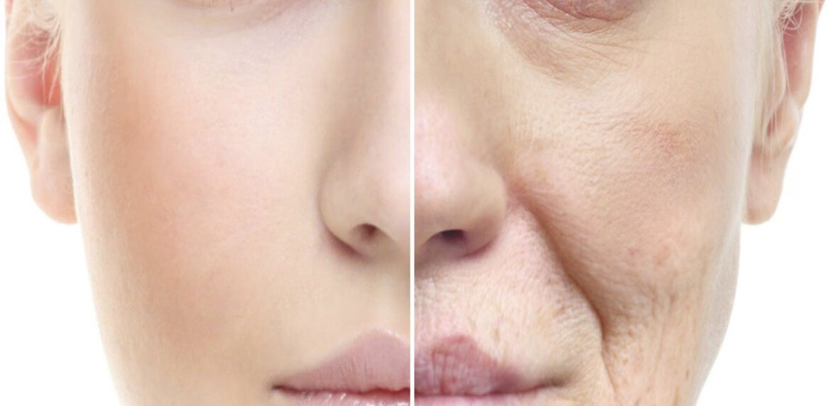 5 نکته مهم پیری زودرس پوست