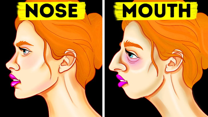 تنفس از طریق دهان- تغییر شکل صورت