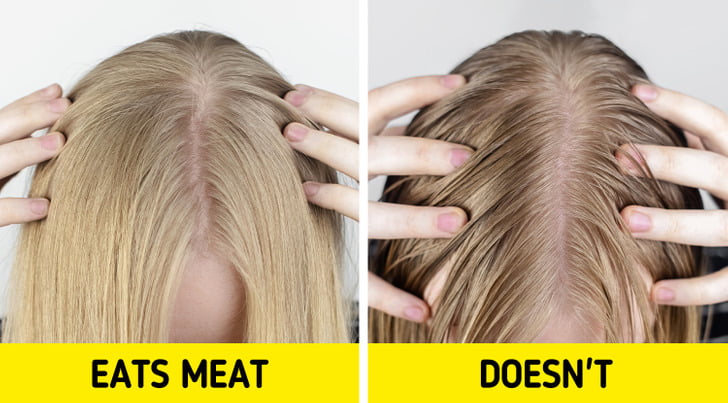 عوارض حذف ناگهانی گوشت:ریزش موی بیشتر
