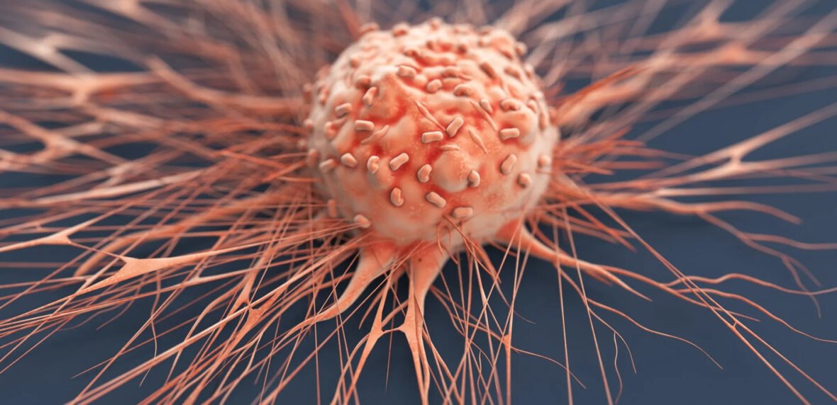 افزایش ابتلا به سرطان